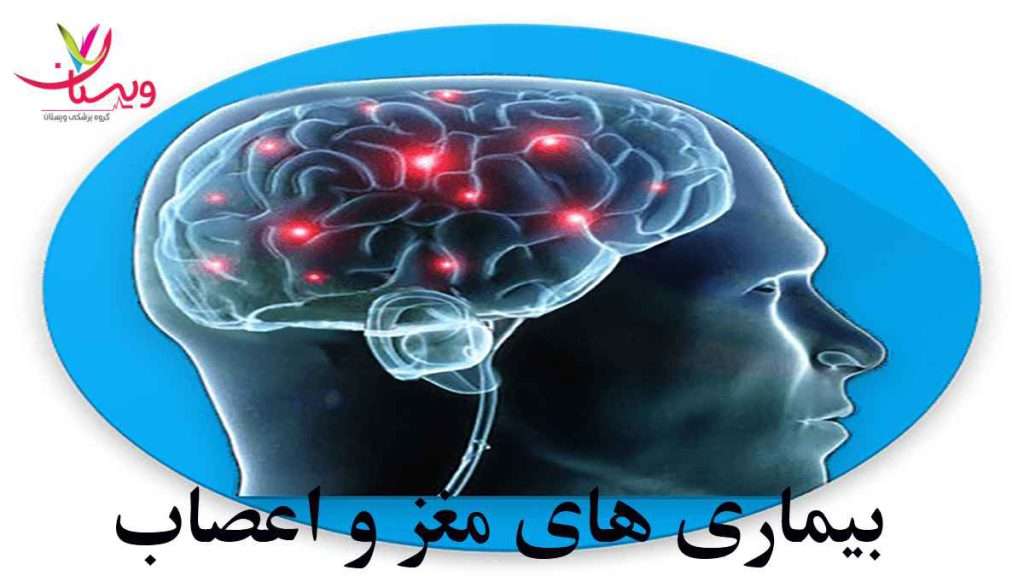بیماری های مغز و اعصاب